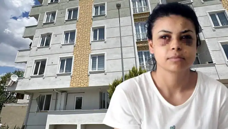 Düğün Kutlamasında Maganda Dehşeti: Bir Genç Kızın Hayatı Tehlikede!