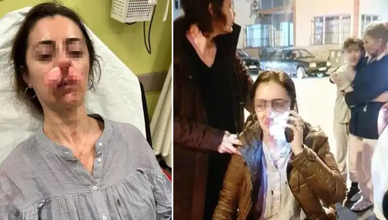 Otomobil Kapısı Silah Sayıldı: Eşinin Sevgilisiyle Hesaplaşma